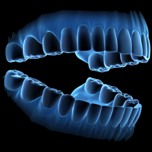 (2)ToothTrauma
